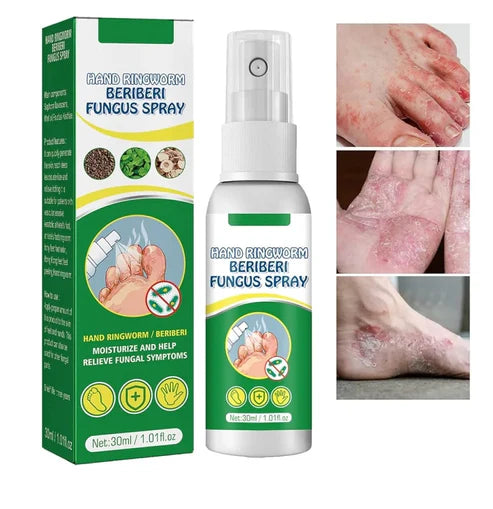 Hand Ringworm Beriberi Fungus Spray
